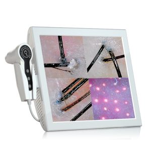 BD-152A Scalp detector Hair Follicle Analyzer | 13 Inch 50X 200X Dual Lens Salon Detector
